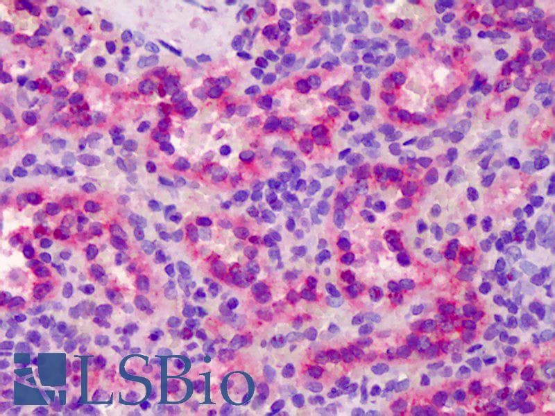 IHC-plus™ Monoclonal Mouse anti-Human NOS3 / eNOS Antibody (clone 6H2, IHC)