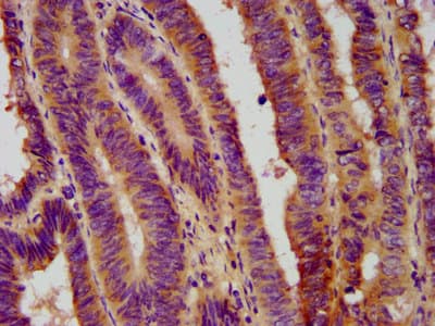 Polyclonal Rabbit anti-Human FERMT1 / Kindlin Antibody (IHC, IF)