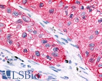 PathPlus™ Polyclonal Rabbit anti-Human GPR32 Antibody (Extracellular Domain, IHC)