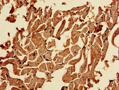 Polyclonal Rabbit anti-Human CAPN1 / Calpain 1 Antibody (aa1-714)