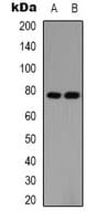 PIAS1 Antibody (N-Terminus)