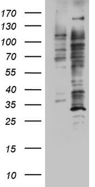 DOT1L / DOT1 Antibody (aa1-434, clone OTI1F6)