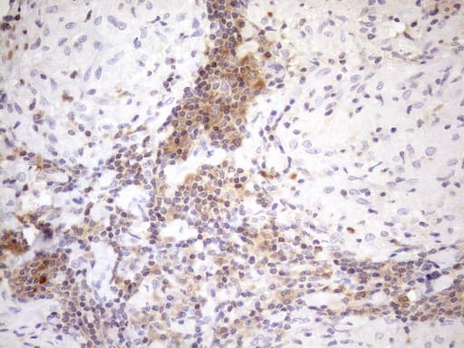 MALT1 Antibody (clone OTI3E10)