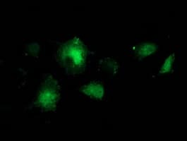 BCAR1 / p130Cas Antibody (clone OTI3A11)