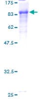 Human SPDL1 / CCDC99 Protein (Recombinant GST)