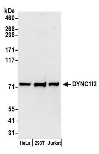 Polyclonal Rabbit anti-Human DYNC1I2 / IC2 Antibody (aa1-50, IHC, WB)