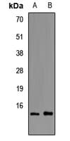 Polyclonal Rabbit anti-Human I-BABP / FABP6 Antibody (IHC, IF, WB)