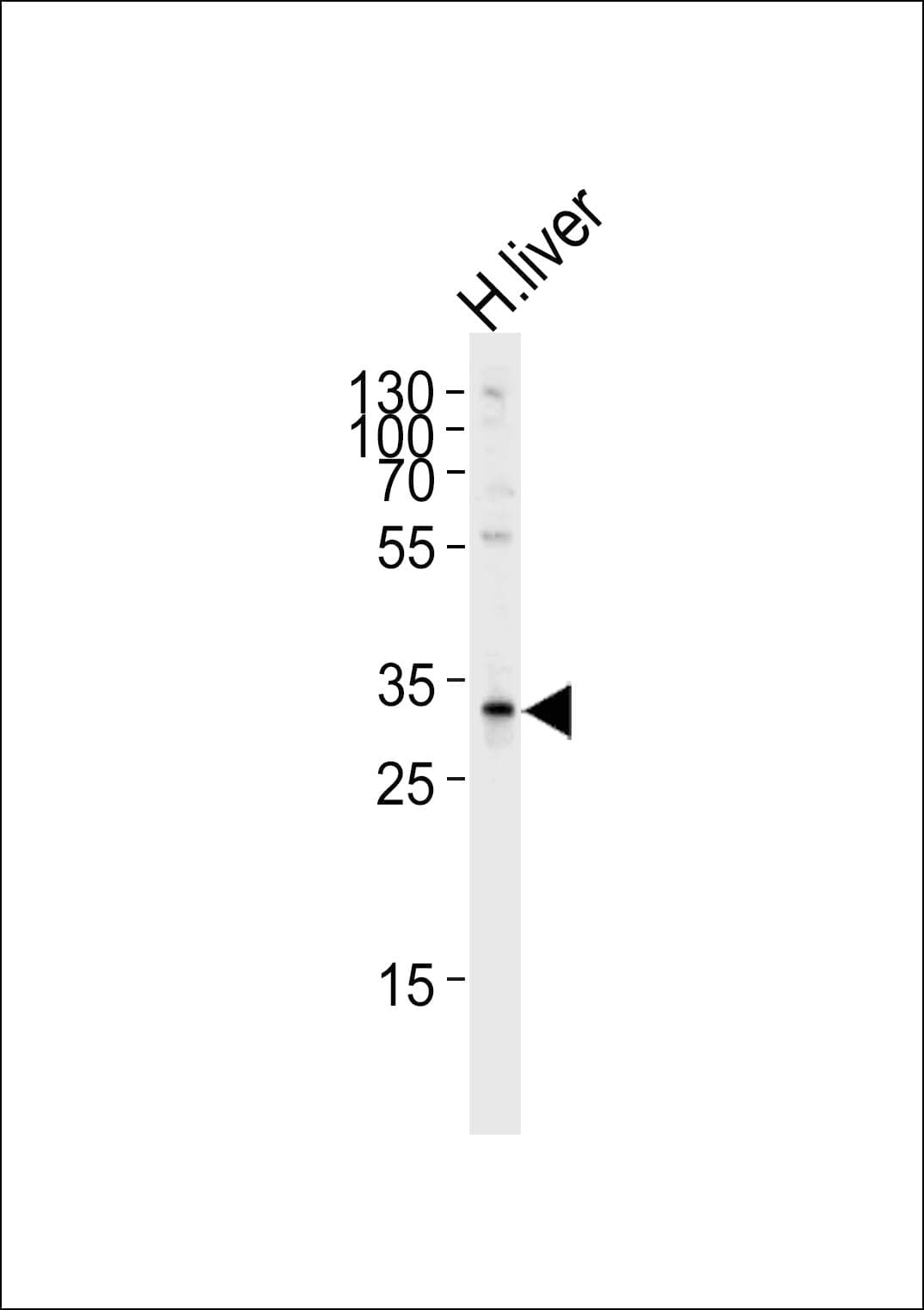 SULT2A1 / Sulfotransferase 2A1 Antibody (aa253-285)