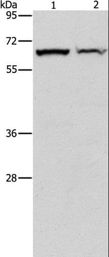 CBS Antibody