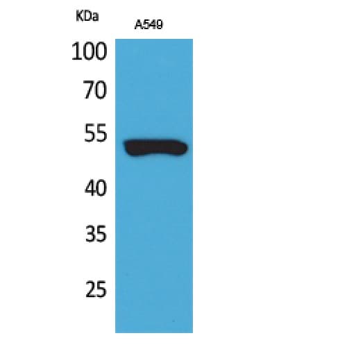 Polyclonal Rabbit anti-Human KRT8 / CK8 / Cytokeratin 8 Antibody (IHC, WB)