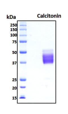 Human Calcitonin Protein (Recombinant 6His, N-terminus + Mouse IgG Fc, C-terminus)