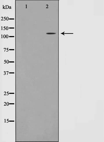 RBM26 / SE70 Antibody