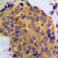 WNT1 Antibody (C-Terminus)