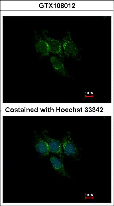 IHC-plus™ Polyclonal Rabbit anti-Human GSTA1 Antibody (IHC, WB)