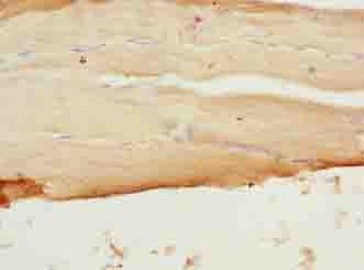 Polyclonal Rabbit anti-Human SFXN4 Antibody (IHC, WB)