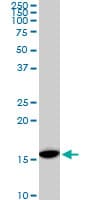 RPS23 / Ribosomal Protein S23 Antibody (clone 1E3)