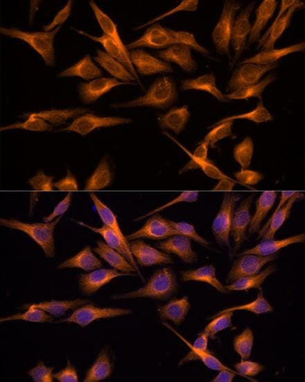 UNG / Uracil DNA Glycosylase Antibody