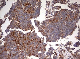 PathPlus™ B2M / Beta 2 Microglobulin Antibody (clone OTI1A9)