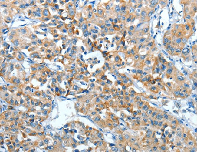 Polyclonal Rabbit anti-Human ADRA1B / Adrenoceptor alpha 1B Antibody (IHC, WB)