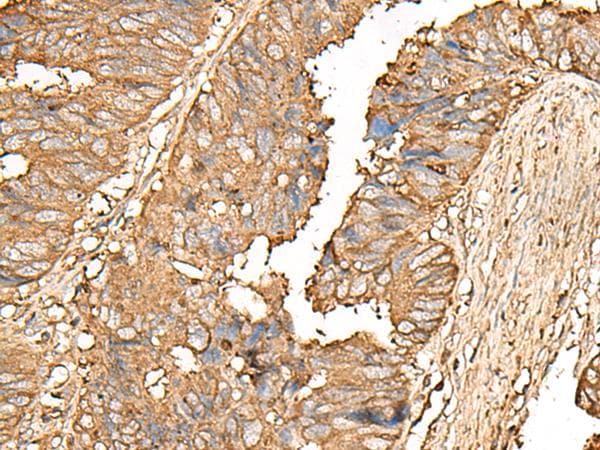 UBE2A Antibody