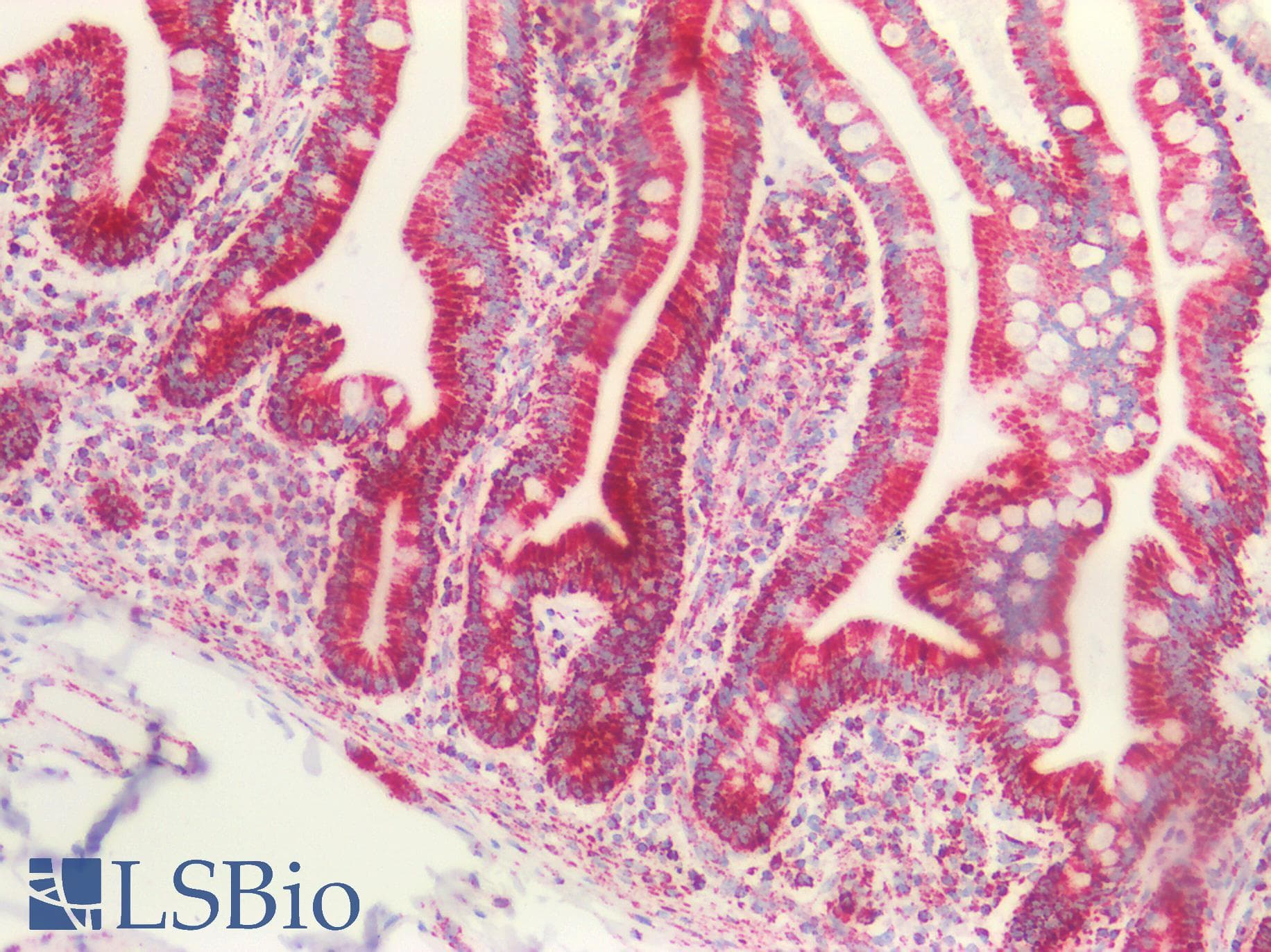PathPlus™ PVR / CD155 Antibody (aa314-342)