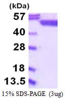 Human SHMT / SHMT1 Protein (Recombinant His)