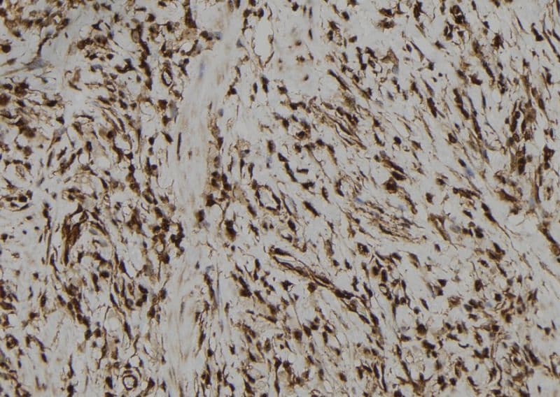 PBXIP1 / HPIP Antibody