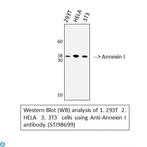 Polyclonal Rabbit anti-Human ANXA1 / Annexin A1 Antibody (IHC, WB)