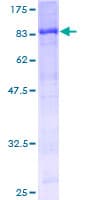 Human STK33 Protein (Recombinant GST)
