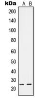 Polyclonal Rabbit anti-Human RIT1 Antibody (C-Terminus, WB)