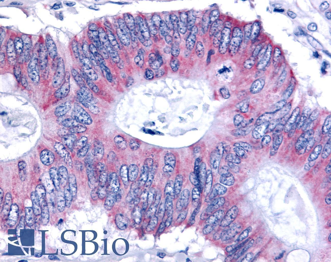 PathPlus™ ESRRB / ERR Beta Antibody (Internal)