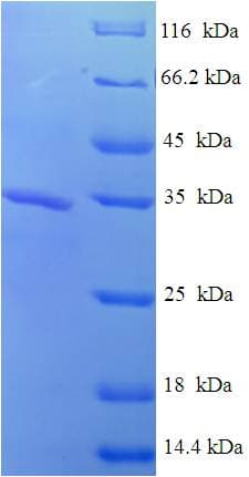 Loxosceles amazonica Phospholipase D LamSicTox-alph Protein (Recombinant His)