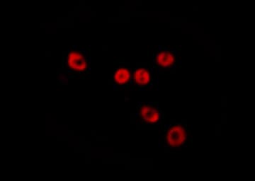 PSMC6 Antibody
