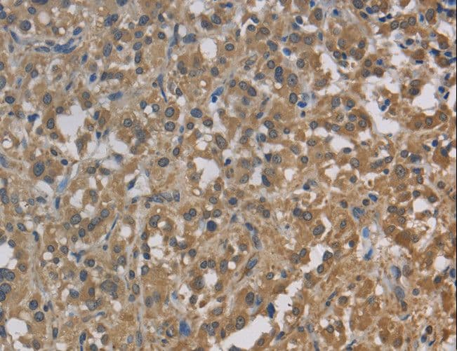 CYB5A / Cytochrome b5 Antibody