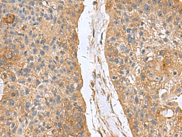 MARCKSL1 Antibody