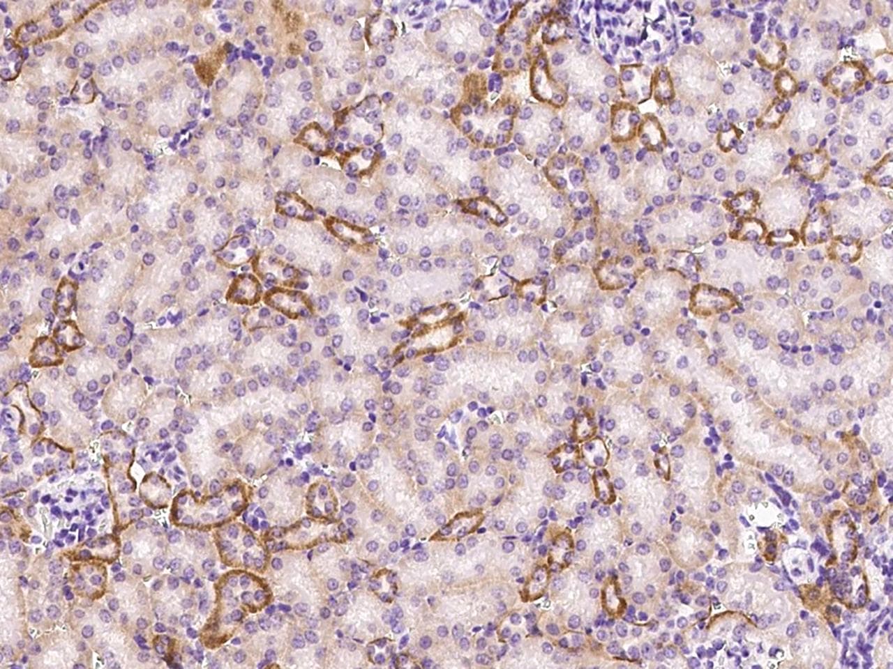 RIPK1 / RIP Antibody (Preservative Free)
