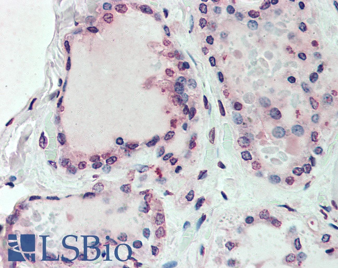 IHC-plus™ Polyclonal Rabbit anti-Human EMB/ Embigin Antibody (Internal, IHC)