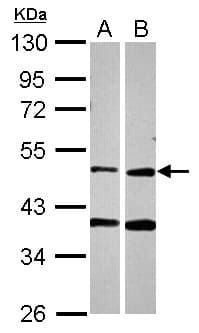 Polyclonal Rabbit anti-Human PPOX Antibody (WB)