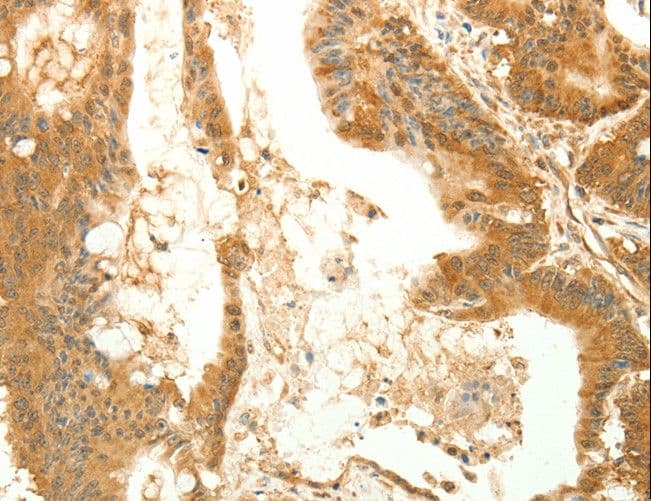 Polyclonal Rabbit anti-Human RARRES1 Antibody (IHC)