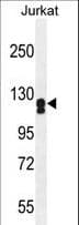 ADCY2 / Adenylate Cyclase 2 Antibody (aa451-481)