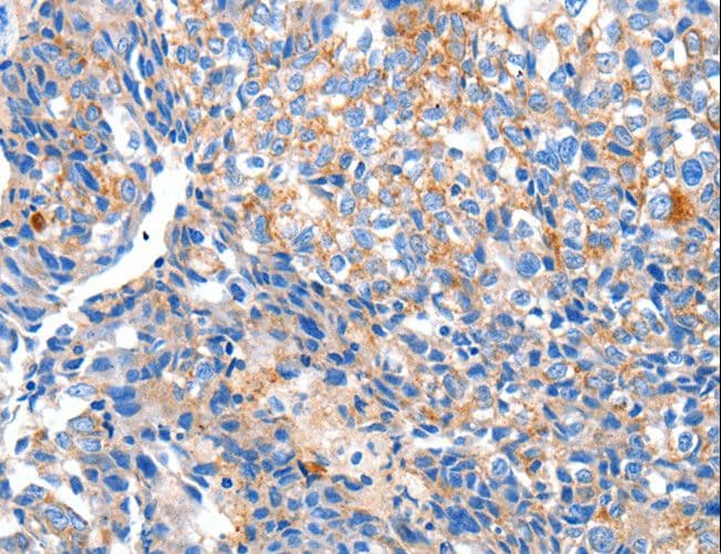 HCN2 Antibody