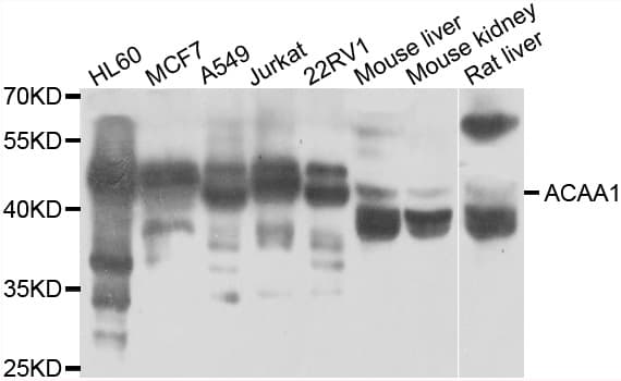 ACAA1 Antibody