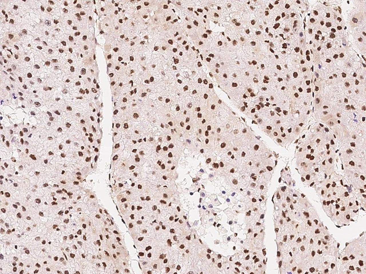ONECUT1 / HNF6 Antibody (Preservative Free)