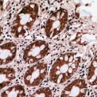 Polyclonal Rabbit anti-Human GRTP1 Antibody (IHC, WB)