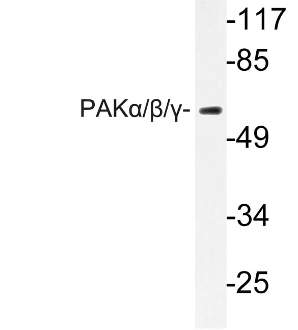 PAK1 + PAK2 + PAK3 Antibody (Glu417/396/415)