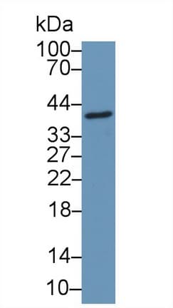 CCDC3 Antibody (aa22-251, APC)