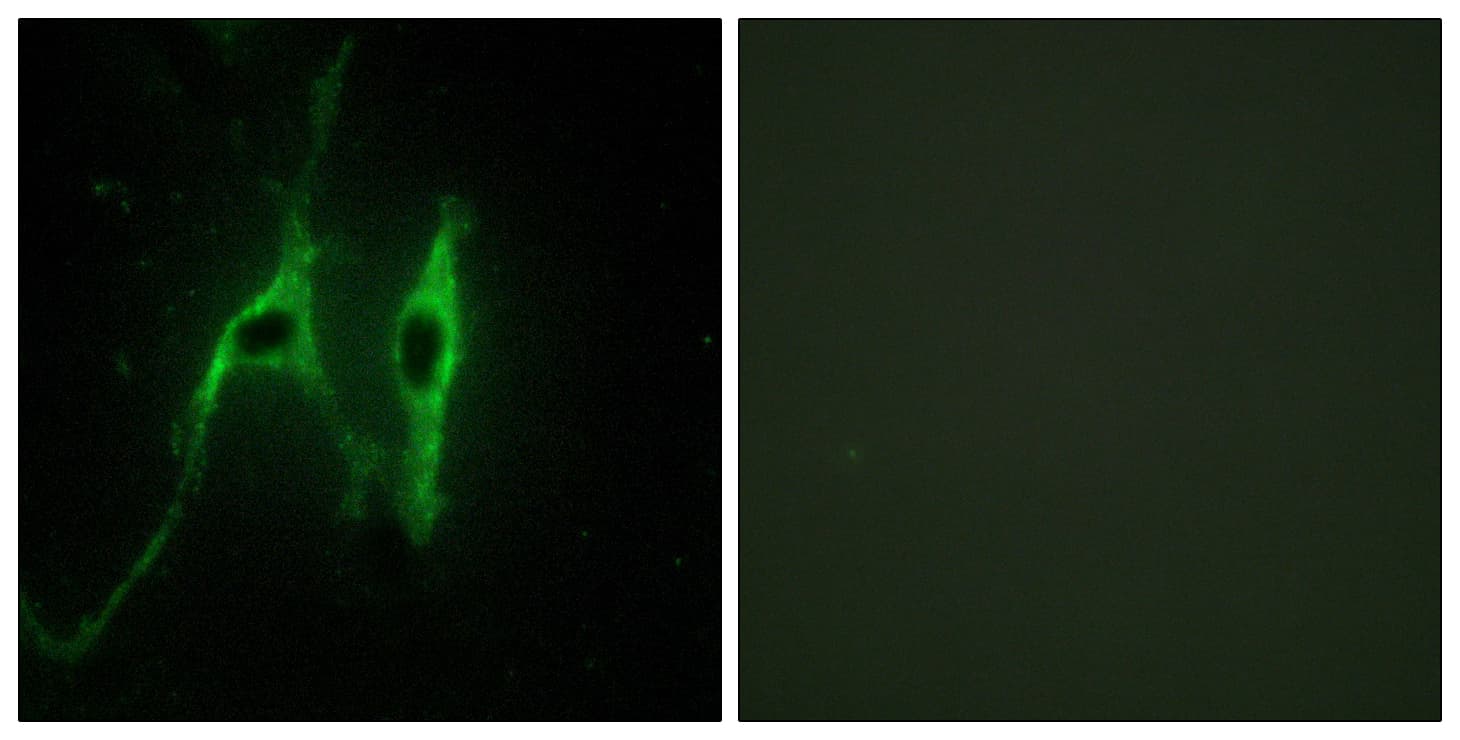 CYB5A / Cytochrome b5 Antibody (aa61-110)