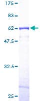 Human CAPZA1 / CAPZ Alpha 1 Protein (Recombinant GST)