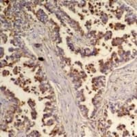 Polyclonal Rabbit anti-Human FLOT2 / Flotillin 2 Antibody (IHC, WB)