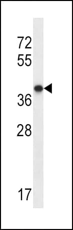 P2RY1 / P2Y1 Antibody (aa231-260)